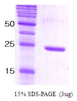 3ug by SDS-PAGE under reducing condition and visualized by coomassie blue stain.