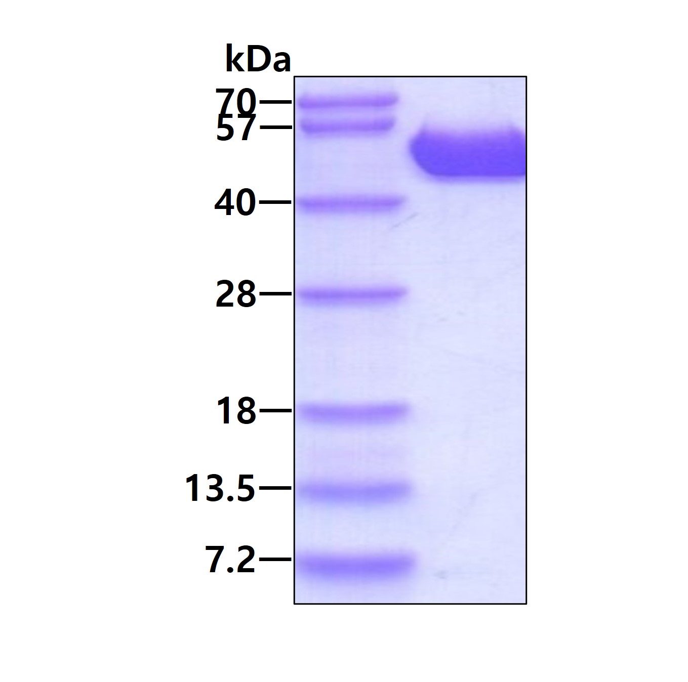 Recombinant human DS...