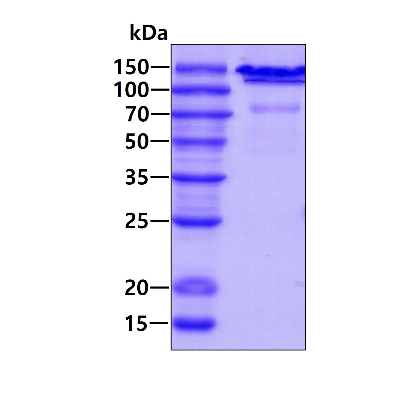 Recombinant human AP...