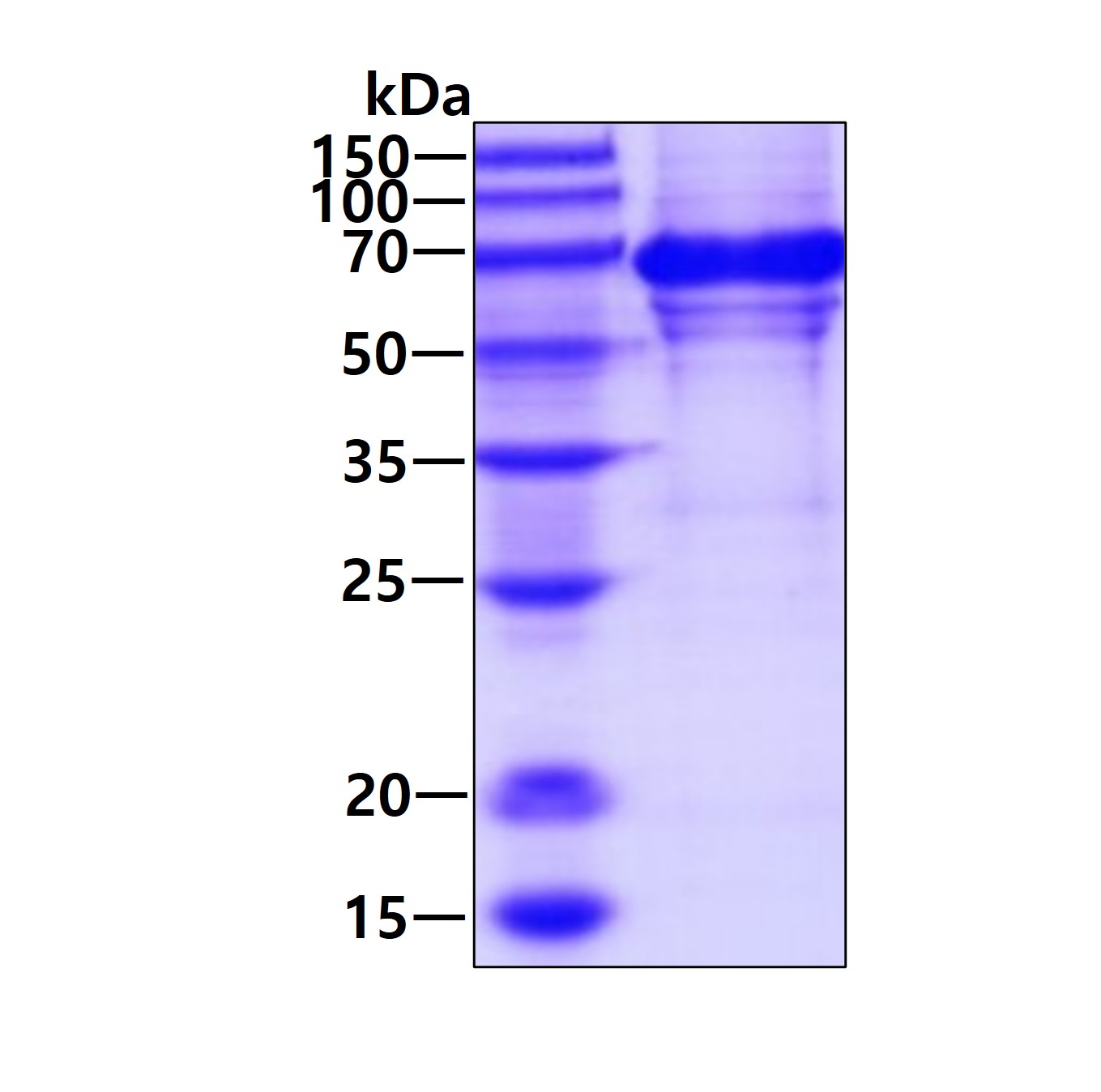 Recombinant human Vi...